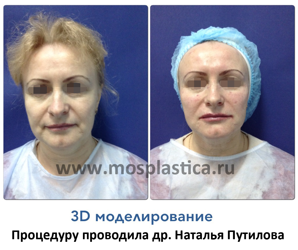 3D моделирование лица от Путиловой Натальи Юрьевны