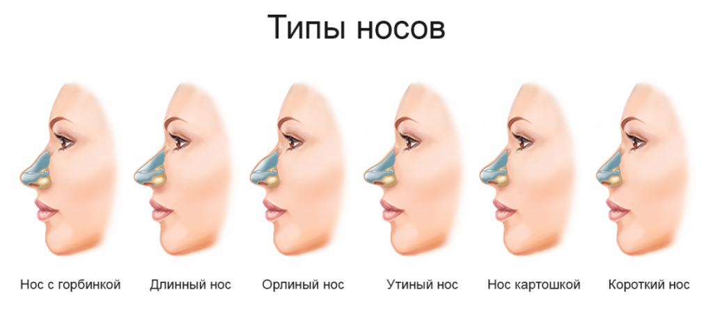 схема: типы носов
