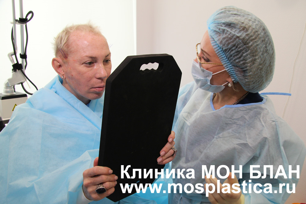 Установка рассасывающихся нитей Александру Пескову. Косметолог Наталья Путилова Установка рассасывающихся нитей Александру Пескову. Косметолог Наталья Путилова