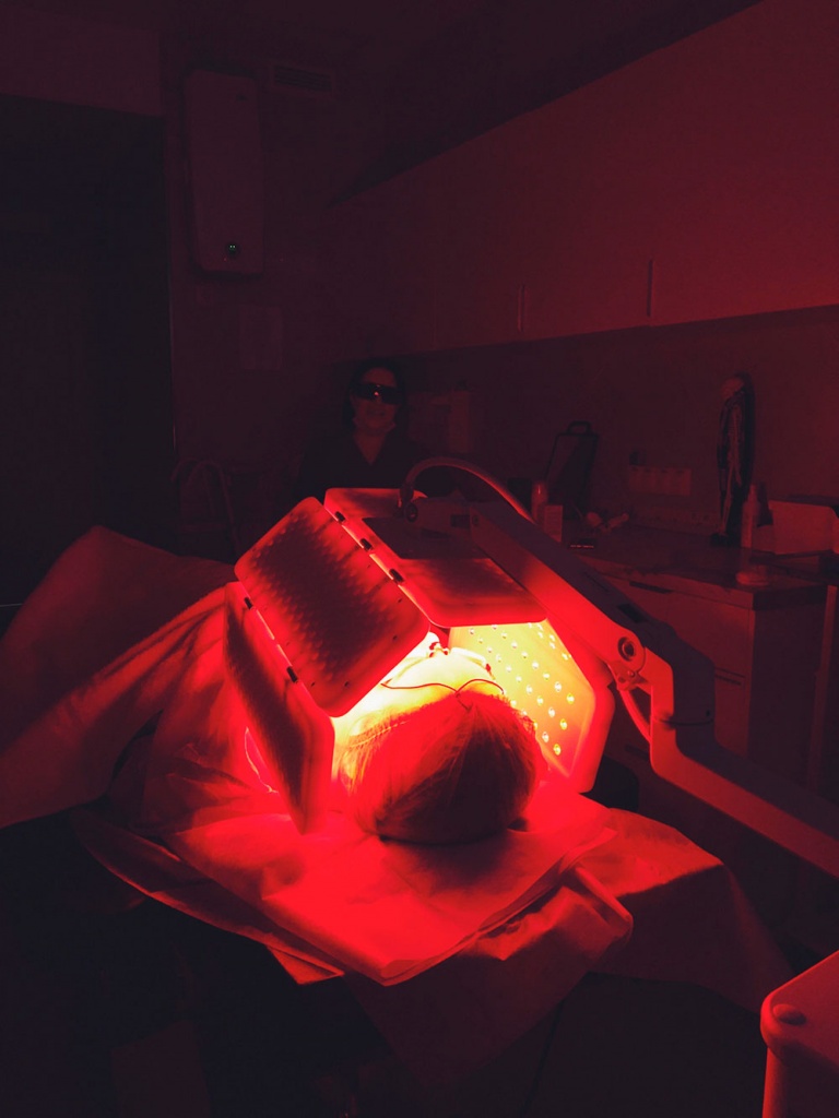 фото проведения процедуры фотодинамической терапии HELEO4