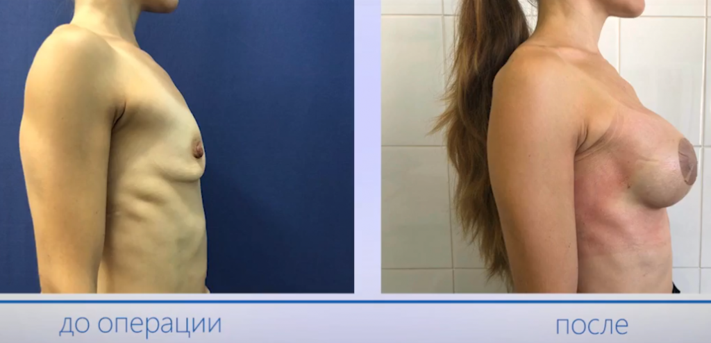 Пациентка Ведрова О. В. фото до и после