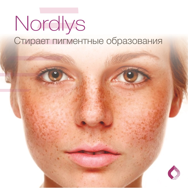 удаление пигментных пятен кожи с помощью терапии Nordlys