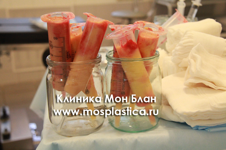 Количество удаленного геля