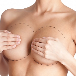 Тубулярная грудь: варианты коррекции